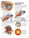 Understanding Glaucoma Anatomical Chart